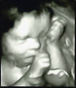 10502422_101526572370176421_3456540849396388258_n